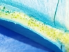 CELLSURE® tehnologija